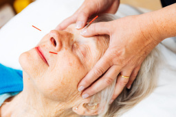 Main photo for One Acupuncture